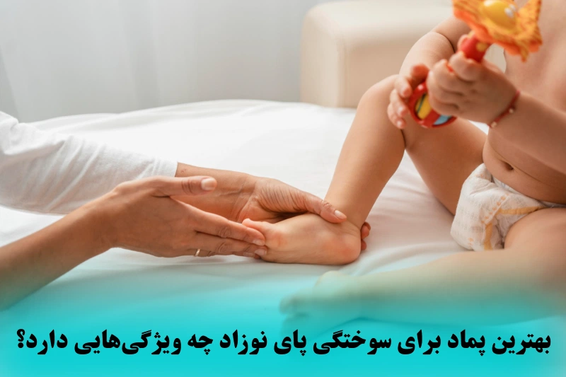 ویژگی های بهترین پماد سوختگی پای نوزاد