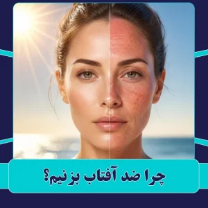 چرا ضد آفتاب بزنیم؟
